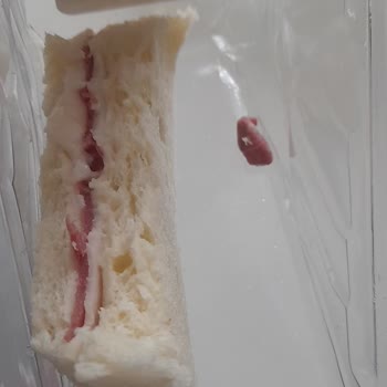 Sandviçte Bulunan Sert Kemik Parçası Çocukların Dişine Ve Boğazına Tehlike Oluşturdu