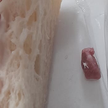 Sandviçte Bulunan Sert Kemik Parçası Çocukların Dişine Ve Boğazına Tehlike Oluşturdu