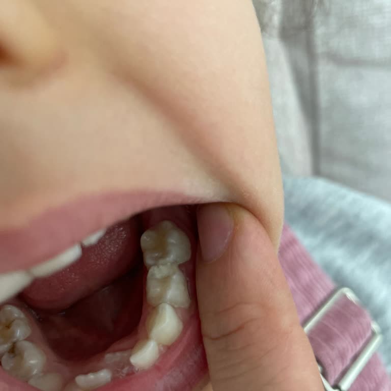 Kızım İçin Gerçek Dolgu Yapmayan Doktorun İlgisiz Davranışı