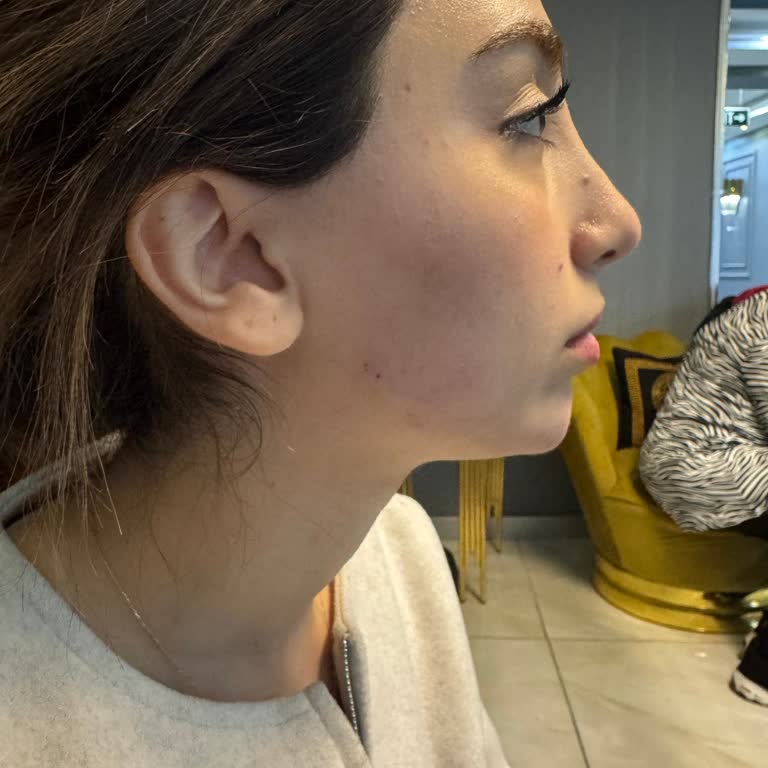 Bakırköy İlya Clinic Botoks Yerine Su Basmışlar