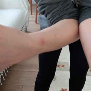 Mondi Home Yatak Takımında Tahtakurusu Ve Sağlık Riski