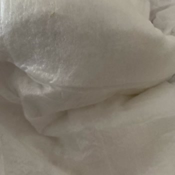 Bebek Bezinde Sivri Cisim Tehlikesi Ve Şirketin İlgisiz Yanıtı