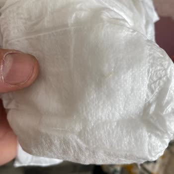 Bebek Bezinde Sivri Cisim Tehlikesi Ve Şirketin İlgisiz Yanıtı