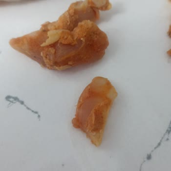 Migros Ankara Mağazasında Satın Alınan Pişmemiş Döner Gıda Güvenliği Sorunu