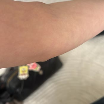 Kan Alımında Özensiz Uygulama Ve Personel İlgisizliği