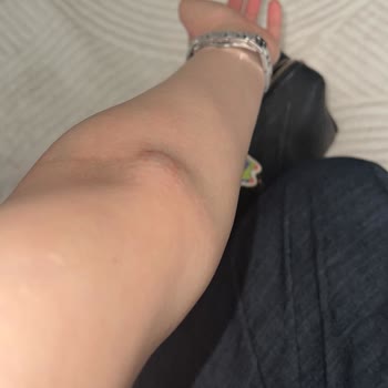 Kan Alımında Özensiz Uygulama Ve Personel İlgisizliği