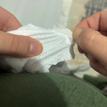 Molfix Bebek Bezinde Bel Bantı Kopması Dolayısıyla Ürün Ziyan Oldu