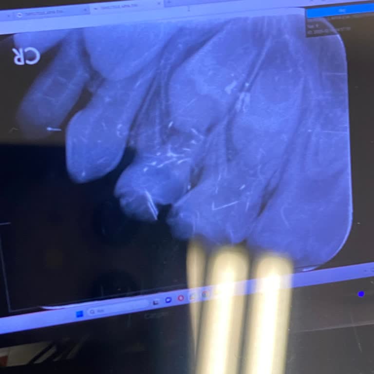 Kku Diş Hekimliği Fakültesi 6 Yaşındaki Çocuğu Korkutmaları