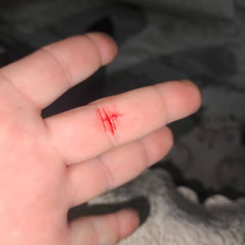 Avşar Maden Suyu Şişelerinde Cam Kırıkları: Sağlık Ve Güvenlik Tehlikesi