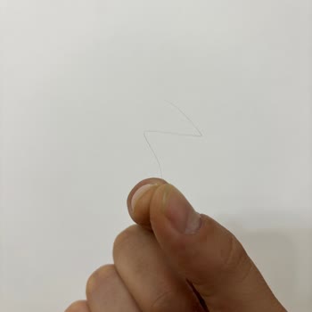 Hijyen Skandalı: Çocuk Doğum Gününde Pastada Saç Bulunması Ve Özürsüz Yaklaşım