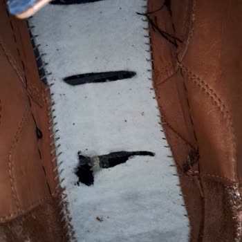 Sert Plastik Tabanlı Sandaletler Bacak Ve Bel Ağrısına Neden Oluyor