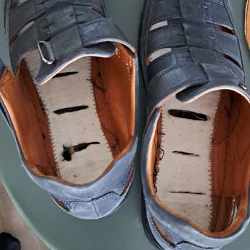 Sert Plastik Tabanlı Sandaletler Bacak Ve Bel Ağrısına Neden Oluyor