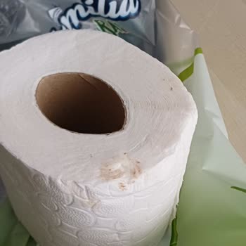 Familia Markanın Paketteki Pis Tuvalet Kağıdı Sağlık Tehlikesi Yaratıyor