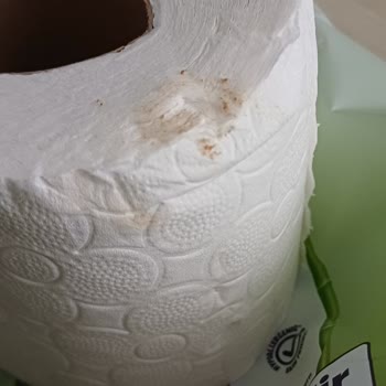 Familia Markanın Paketteki Pis Tuvalet Kağıdı Sağlık Tehlikesi Yaratıyor