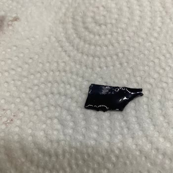 Tamek Çilek Reçelinde Büyük Plastik Parça Çocuk Güvenliğini Tehlikeye Atıyor