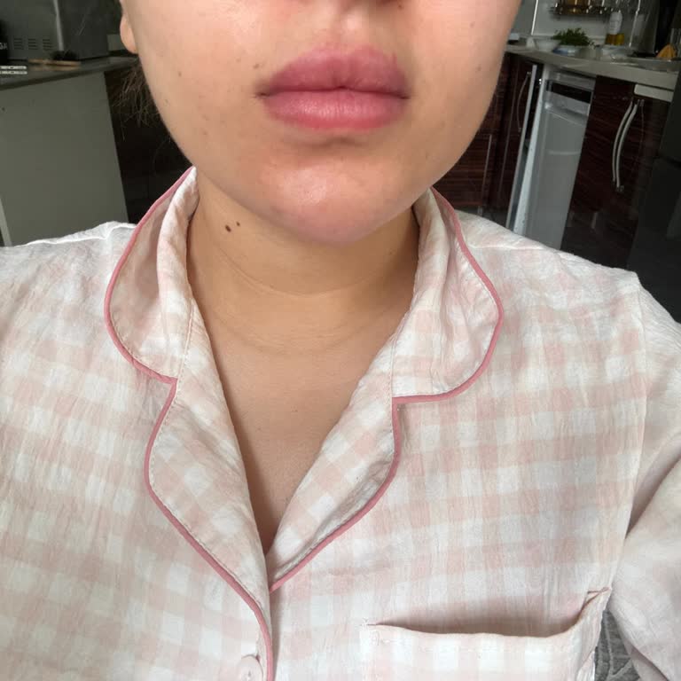 Dr.Ceylipssss Randevu Verilmemesi Nedeniyle Artık Bu Kontrol Seansının da Bir Anlamı Kalmadı