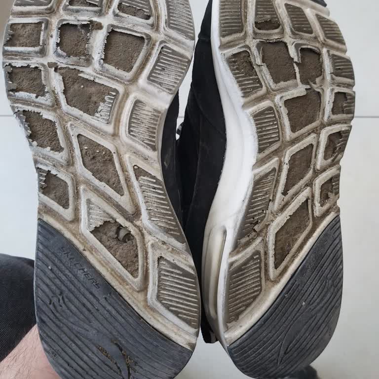 Skechers Ayakkabısının Tabanı Eridi, İade Talebi Reddedildi
