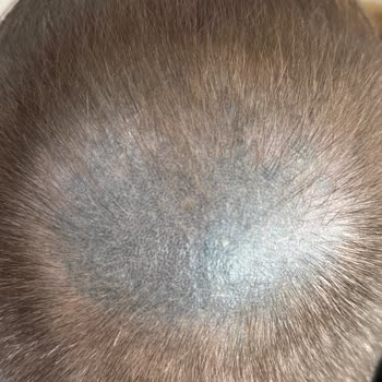 Masmavi Saç Simülasyonu Sonucu Ve İade Talebi