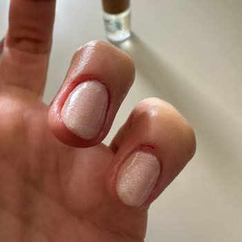 Uyarı: O La Nail & Beauty Avcılar’da Tırnaklarım Şiddetle Zarar Gördü