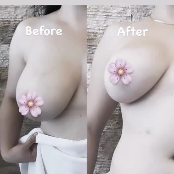 Sosyal Medyada Uygunsuz Güzellik Reklamlarına Şikayet