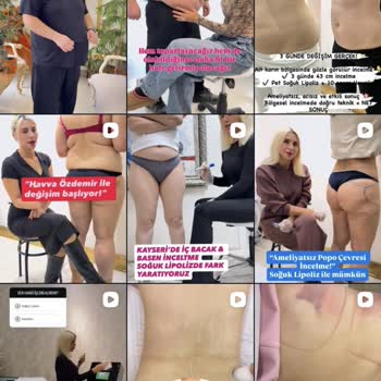 Sosyal Medyada Uygunsuz Güzellik Reklamlarına Şikayet