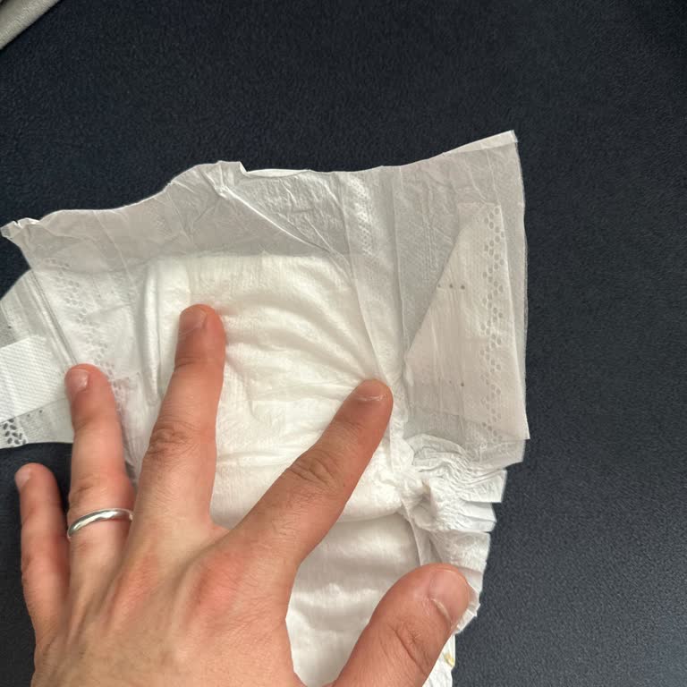 Bebek Bezlerinde Yapışma Sorunu Ve İade Talebi