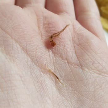 Eskişehir BİM'de Patito Cipsin İçinden Yabancı Cisim Çıktı, Hijyen Kabulu Olmaz