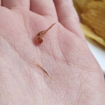 Eskişehir BİM'de Patito Cipsin İçinden Yabancı Cisim Çıktı, Hijyen Kabulu Olmaz