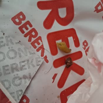 Bereket Döner Şubesinde Saç Ve Kıl Çıktı: Hijyen İhlali