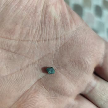 Baklavadaki Taş: Sağlık Riski Ve Ücret İadesi Talebi