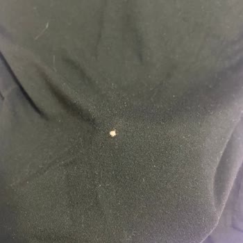 Arçelik Çamaşır Makinesi Gürültüsü Ve Kıyafet Yırtmasıyla Garanti Sürecinde Çözüm Bekleniyor