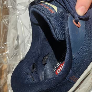 Skechers Ayakkabısında Tek Kullanımda Deformasyon Ve Ayıplı Mal Talebi