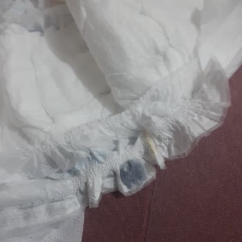 Molfix Bebekte Yabancı Madde Bulundu: Üretim Hatası Şikayeti