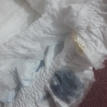 Molfix Bebekte Yabancı Madde Bulundu: Üretim Hatası Şikayeti