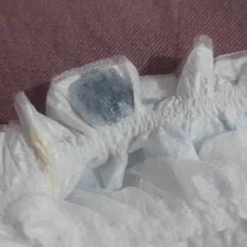 Molfix Bebekte Yabancı Madde Bulundu: Üretim Hatası Şikayeti