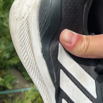 Ayıplı Adidas Ayakkabıda Mesh Açılması Ve Mağaza Reddi
