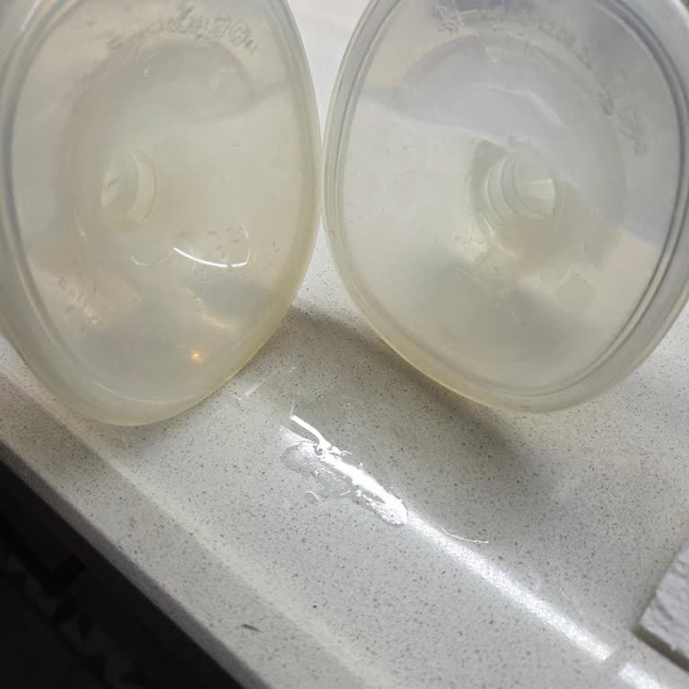 İki Ay Boyunca Çözülmeyen Lansinoh Göğüs Pompası Emiş Gücü Ve Sürekli Süt Akması Sorunu