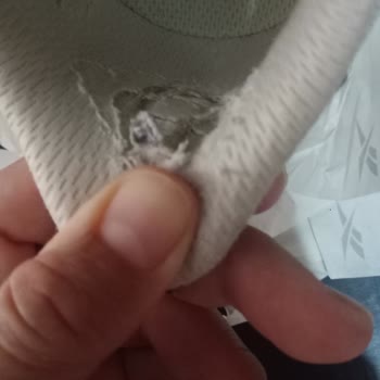 Reebok Ayakkabımda Deformasyon Ve Garanti Red Kararının Haksızlığı