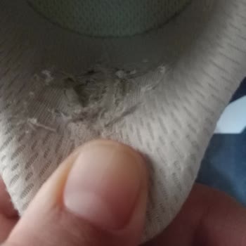 Reebok Ayakkabımda Deformasyon Ve Garanti Red Kararının Haksızlığı