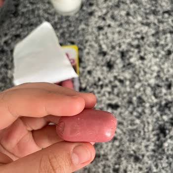 Aç Bitir Sosis Ürünün Bozulması Ve İade İsteği