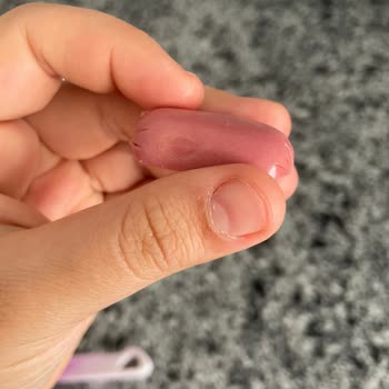 Aç Bitir Sosis Ürünün Bozulması Ve İade İsteği