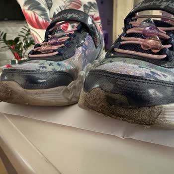 Skechers Kız Çocuk Ayakkabısında Hızlı Deformasyon Ve Boyner'in Red Cevabı