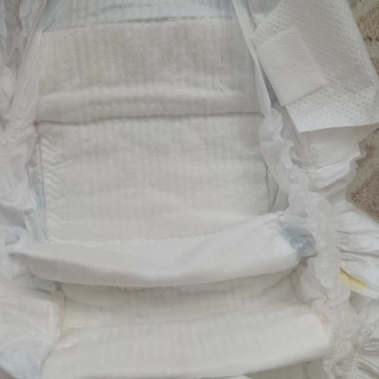 Molfix Premium Bezlerde Sürekli Sızdırma Ve Koruma Eksikliği