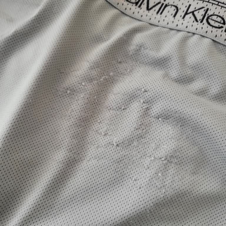 Calvin Klein Boxer’da İlk Kullanımda Tiftiklenme Ve Kalite Sorunu