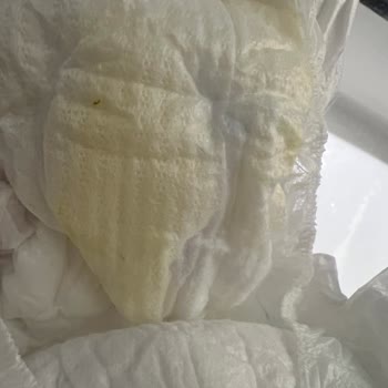 Yoğun Koku Ve Hijyen Sorunu Nedeniyle Molfix Bezinden İade Talebi