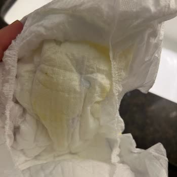 Yoğun Koku Ve Hijyen Sorunu Nedeniyle Molfix Bezinden İade Talebi