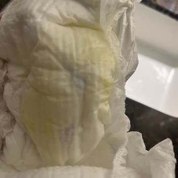 Yoğun Koku Ve Hijyen Sorunu Nedeniyle Molfix Bezinden İade Talebi