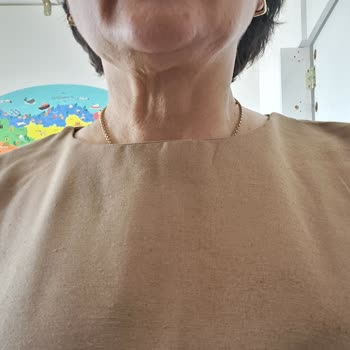 İlanla Uyuşmayan Kalitesiz Ürün Ve İade Reddi