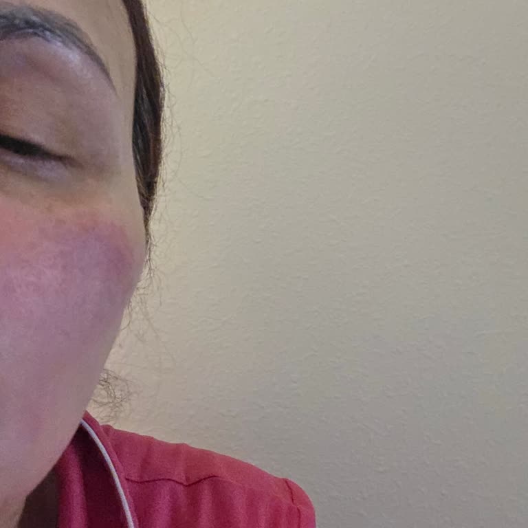 Rash On Face From Clinque Moisturizer Surge