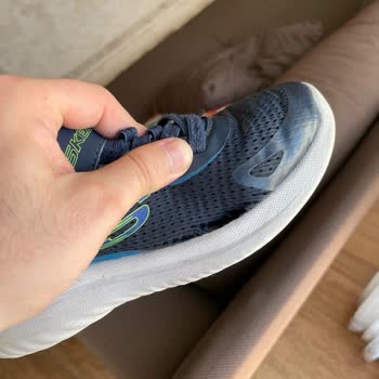 Skechers Çocuk Ayakkabısının Yarım Yılda Kenarından Açılması Ve Üretim Kusuru İade Talebi